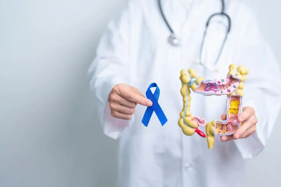 cancerul-colorectal cancerul-colorectal